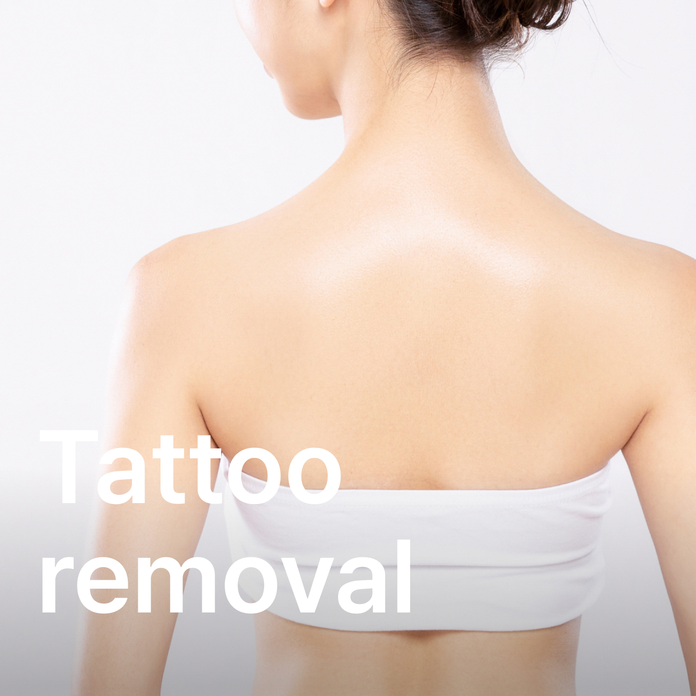 Seoul Tattoo Removal: What Pico Laser Really Costs